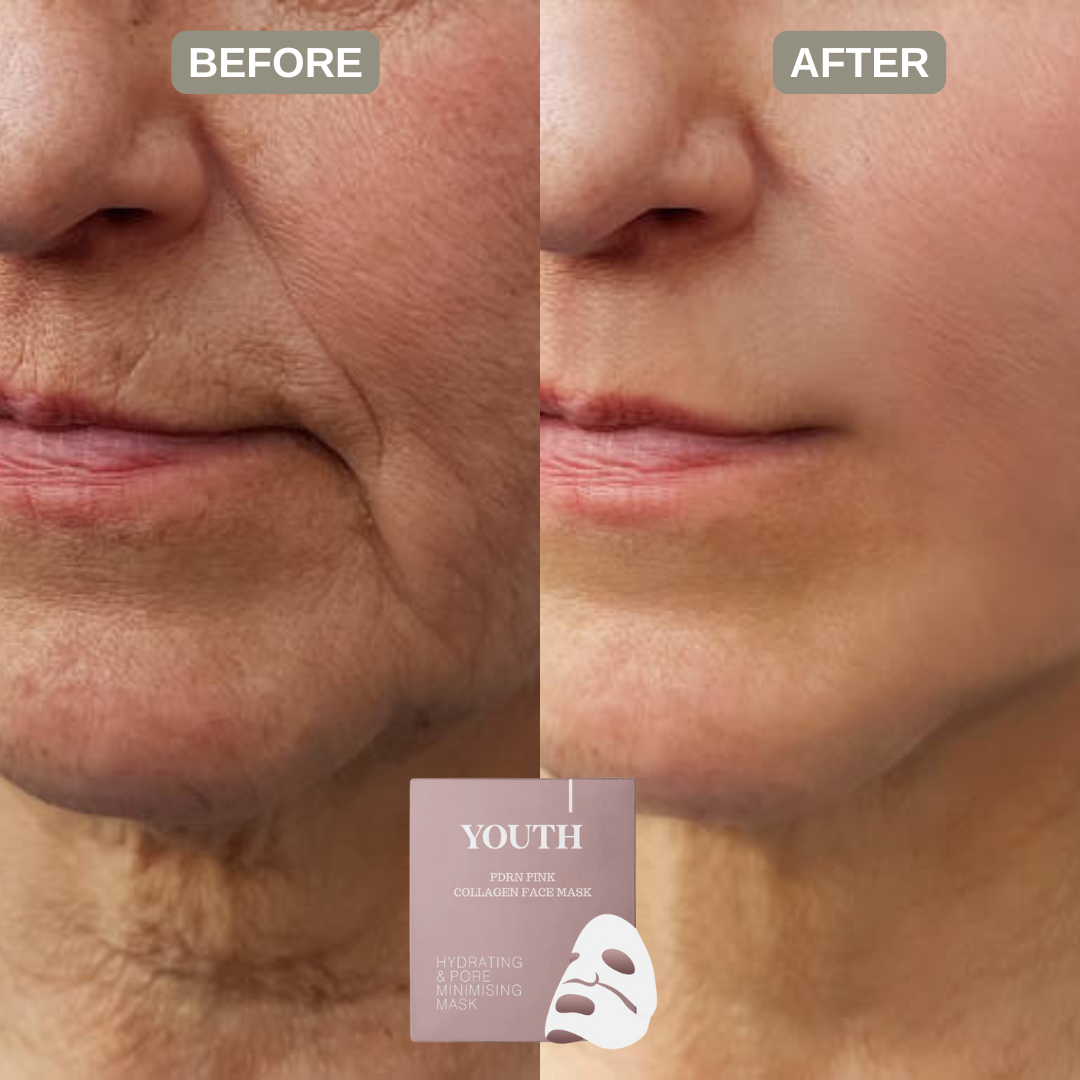 Youth® Salmon PDRN Pink Collagen Face Mask