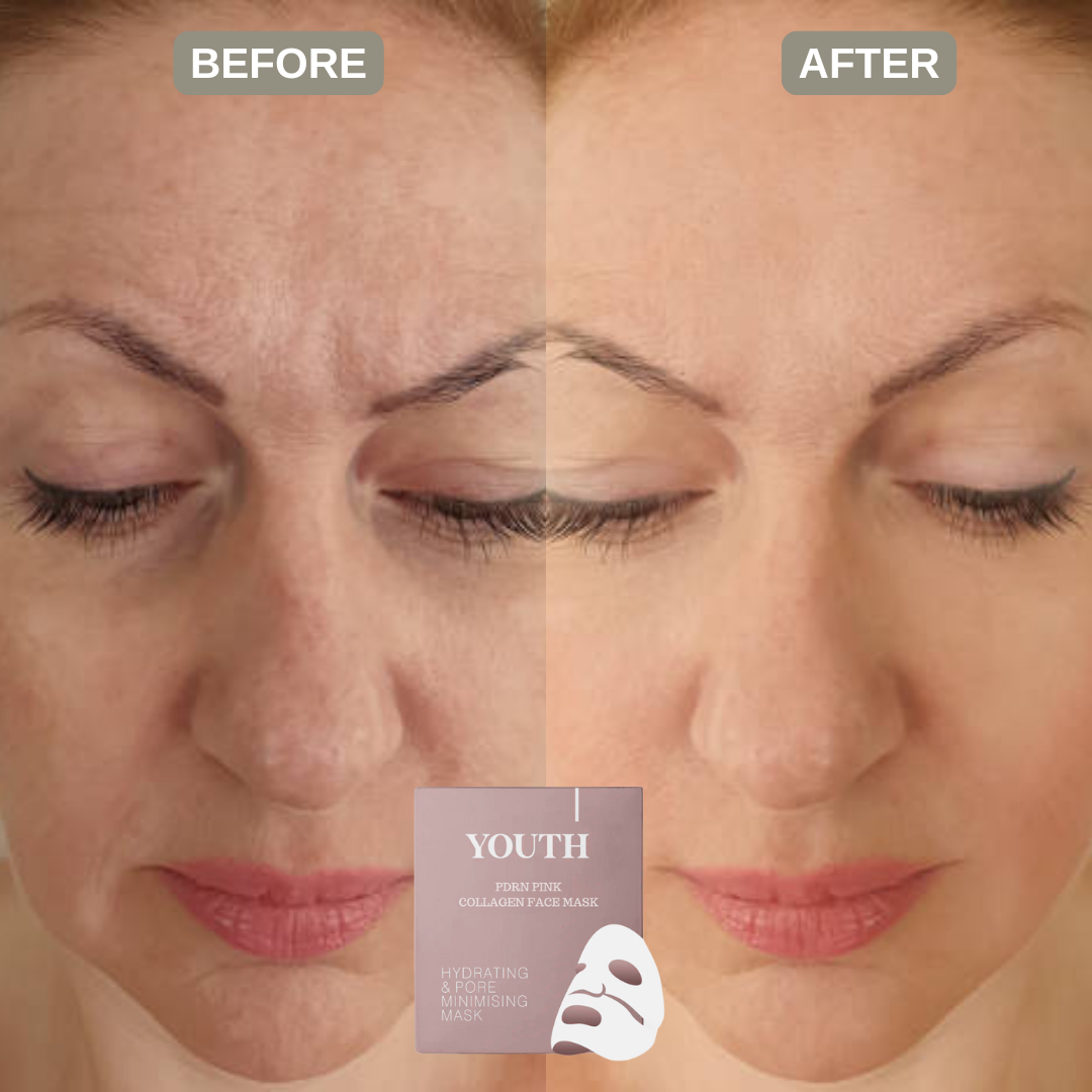 Youth® Salmon PDRN Pink Collagen Face Mask