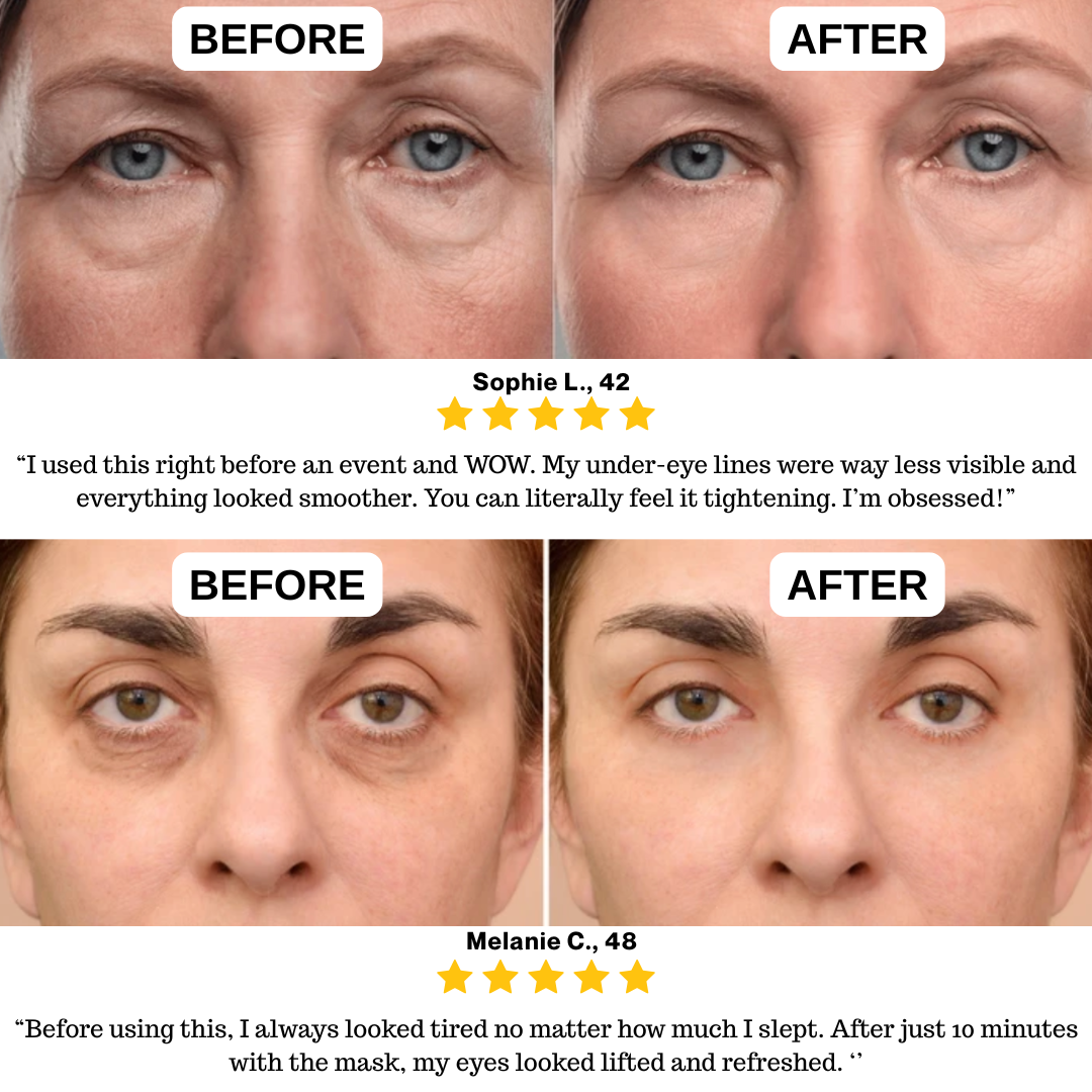 Youth® Freeze-Dried Collagen & 90% Hyaluronic Acid Eye Mask
