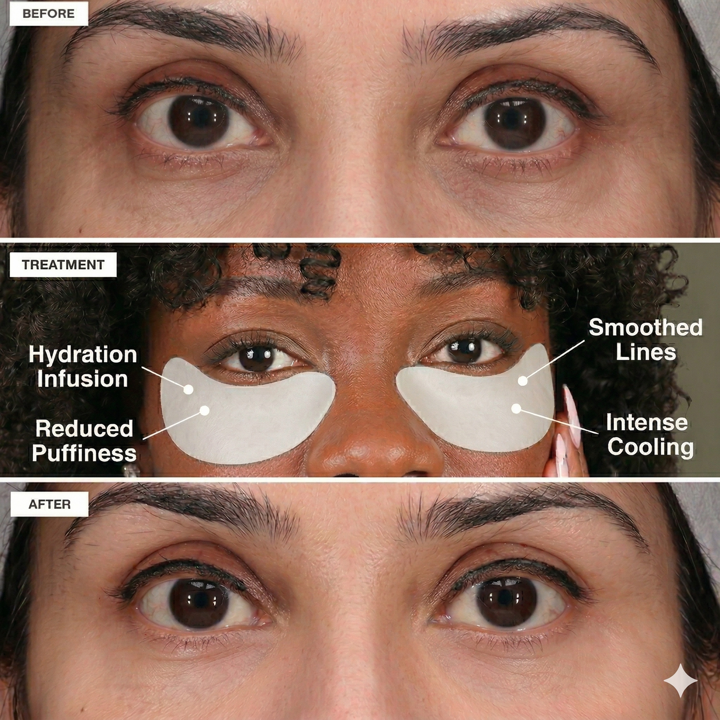 Youth® Freeze-Dried Collagen & 90% Hyaluronic Acid Eye Mask