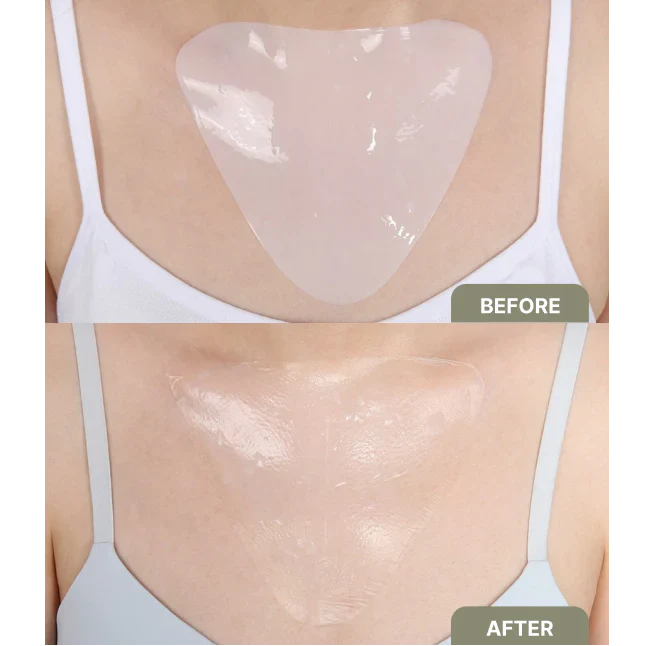 (Limited Offer) Youth Neck & Chest Collagen Treatment + Bonus Face Collagen Masks